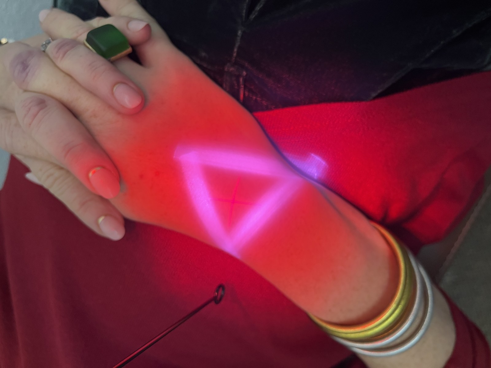 Laser therapy applicator illuminating a patient's wrist
